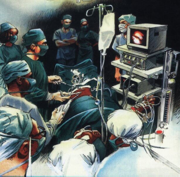 laparoskopic ΓΟΠ Barrett Διαφραγματοκήλη ΓΟΠ Barrett laparoskopic